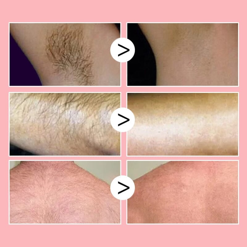 đ„đ„âšSmooth as Honey: Mousse Hair Removal Spray/Smooth as Honey: Mousse Hair Removal Spray