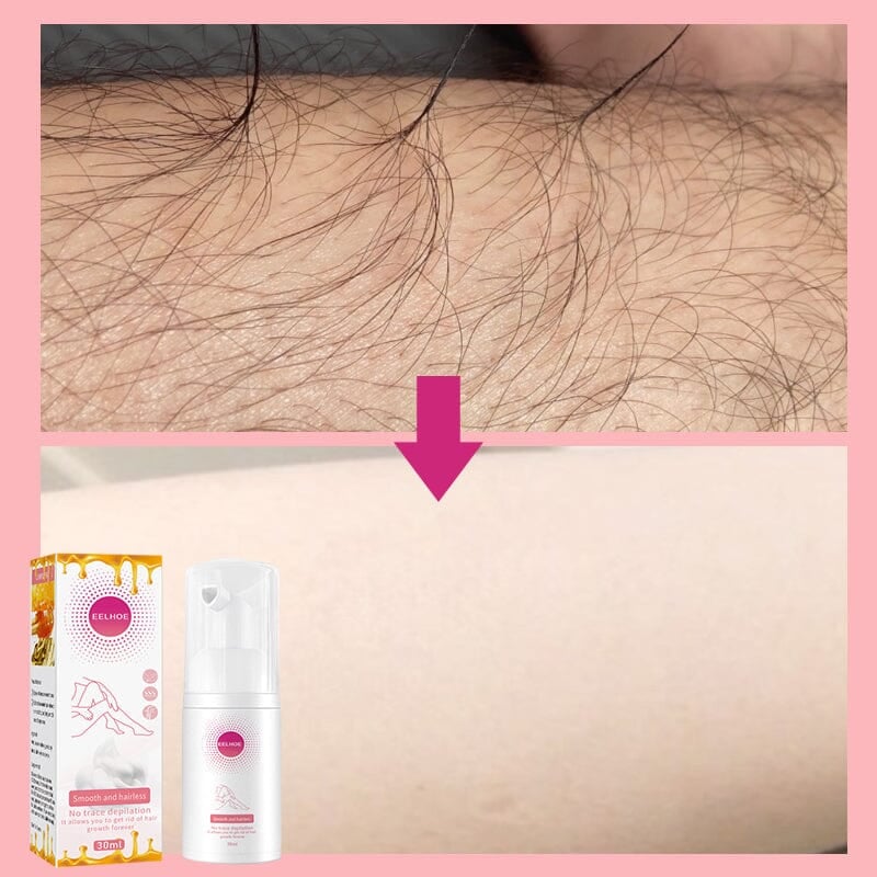 đ„đ„âšSmooth as Honey: Mousse Hair Removal Spray/Smooth as Honey: Mousse Hair Removal Spray