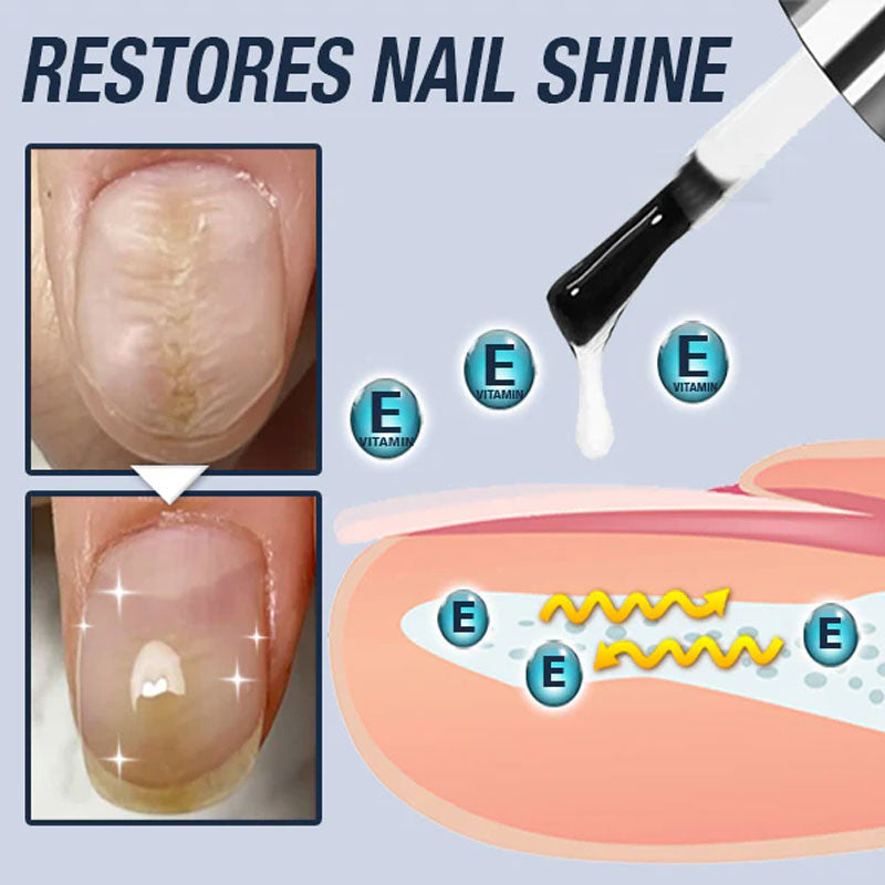 Reparerande nagelserum