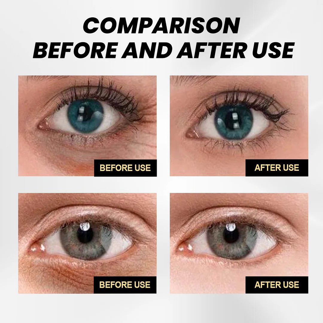 đBuy One Get One Freeđ - Instant Firming Eye Cream