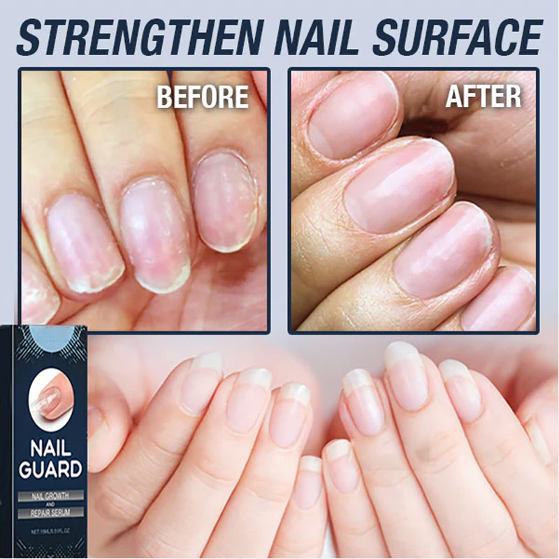 Reparerande nagelserum