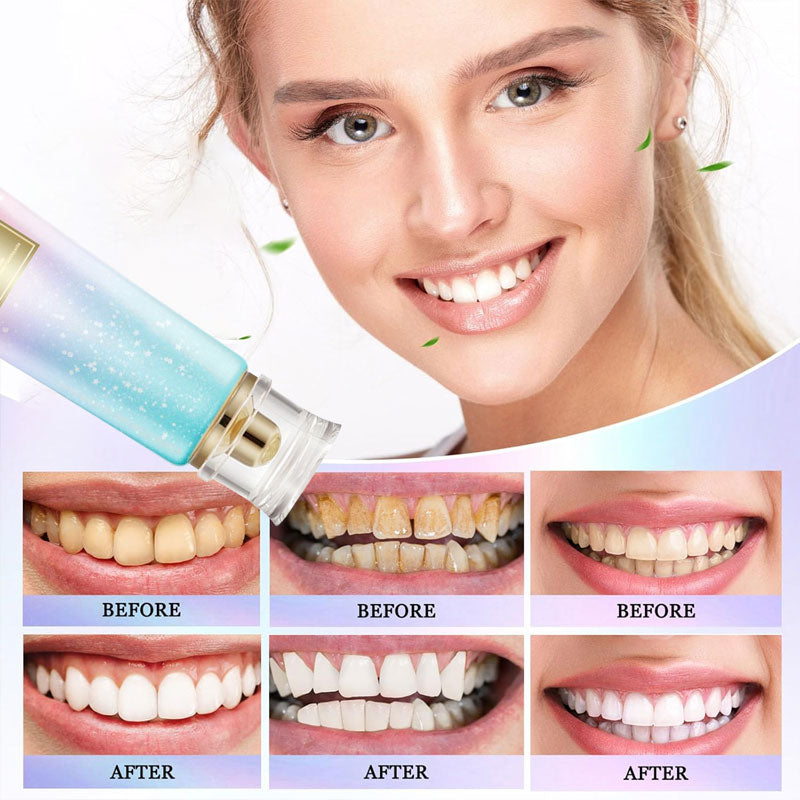 Radiant Whitening Tandkräm