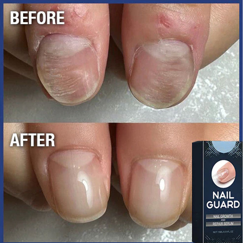 Reparerande nagelserum