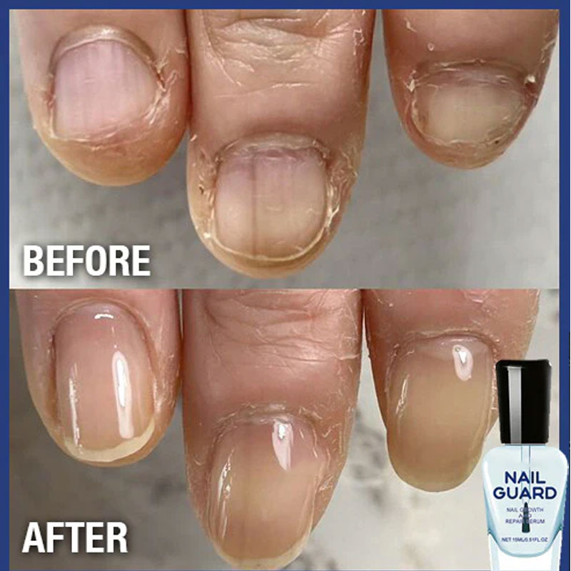 Reparerande nagelserum