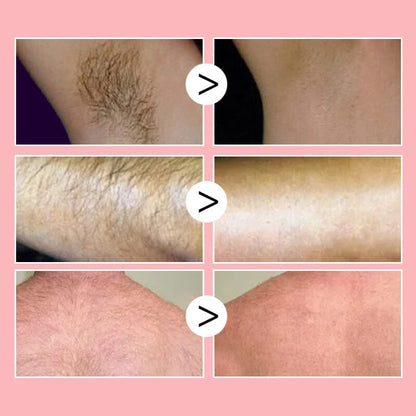 🔥🔥✨Smooth as Honey: Mousse Hair Removal Spray/Smooth as Honey: Mousse Hair Removal Spray