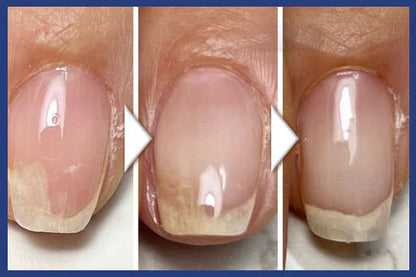 Reparerande nagelserum