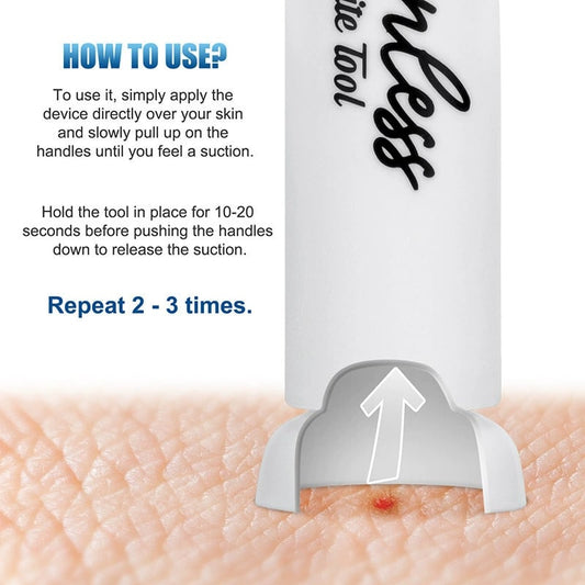 🦟 Upplev omedelbar lindring ✨ Ultimate Bite & Sting Relief Tool - För klåda-fria, bekväma dagar