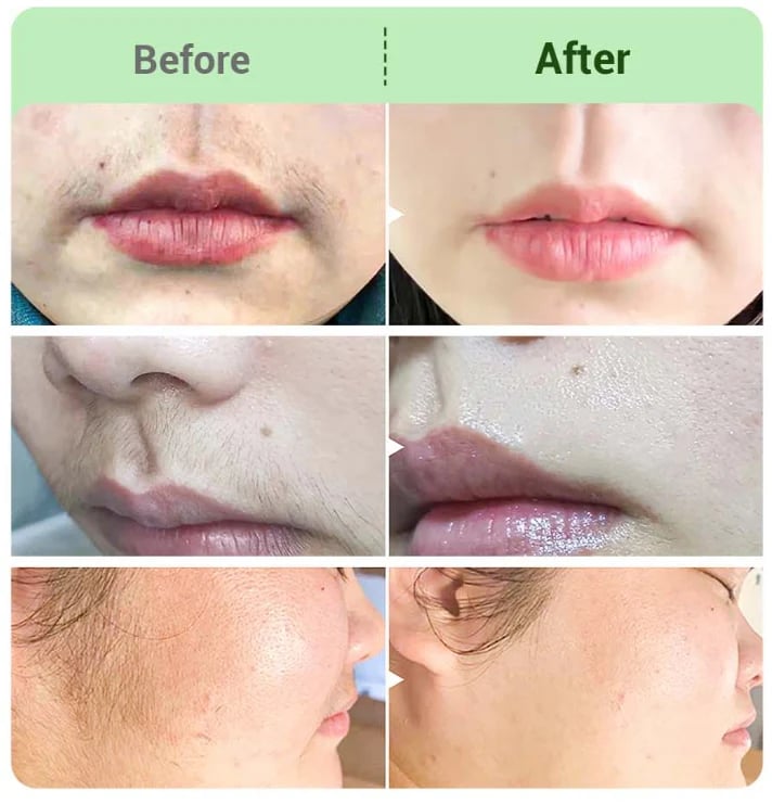 TAILEDEN™ Hair Removal Cream for All Women & Men-Discounted Repeat Purchase