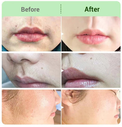 TAILEDEN™ Hair Removal Cream for All Women & Men-Discounted Repeat Purchase