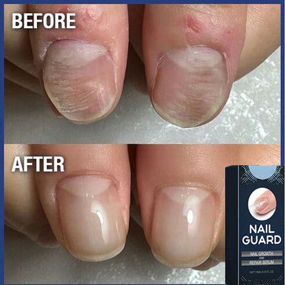 Reparerande nagelserum